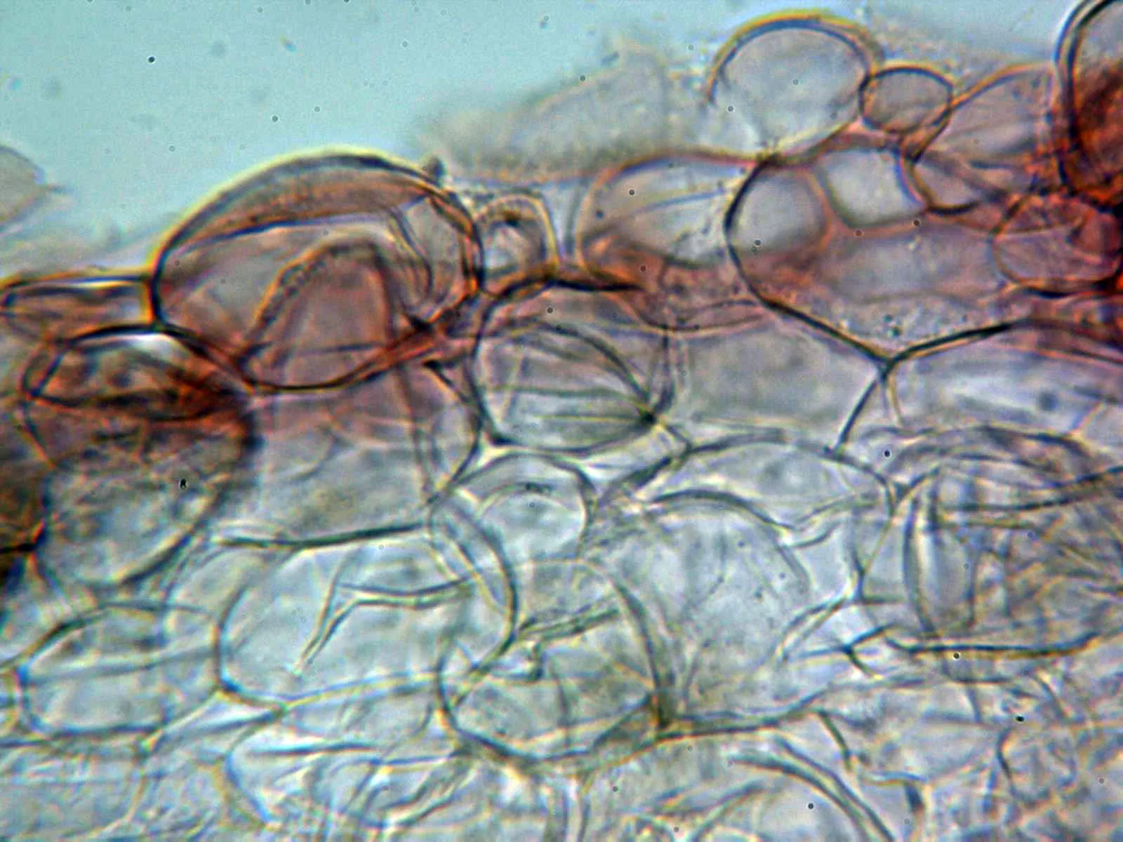 Microscopía de Panaeolina foenisecii - 10 - Suprapellis 2